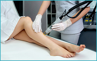 laser hair removal